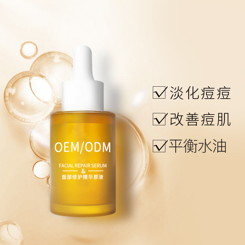 六盘水市_祛痘精华原液OEM